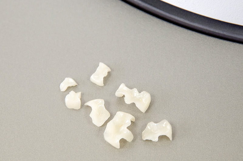 Fotogalerie Dentallabor
