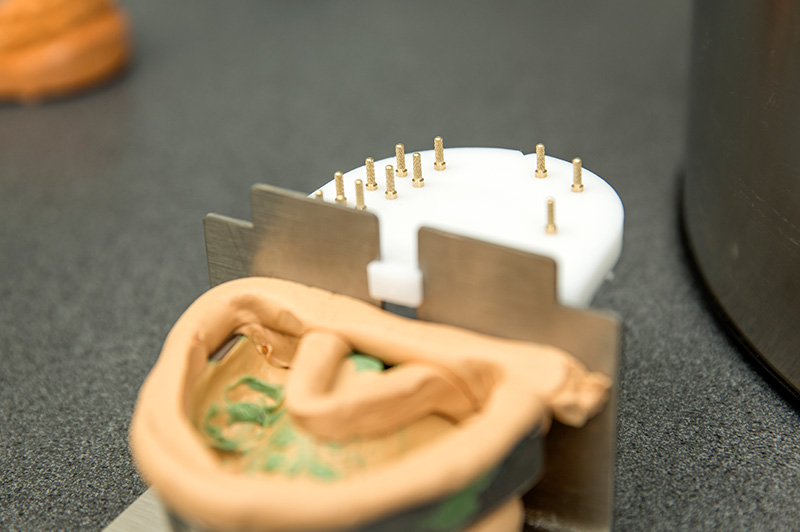 Fotogalerie Dentallabor