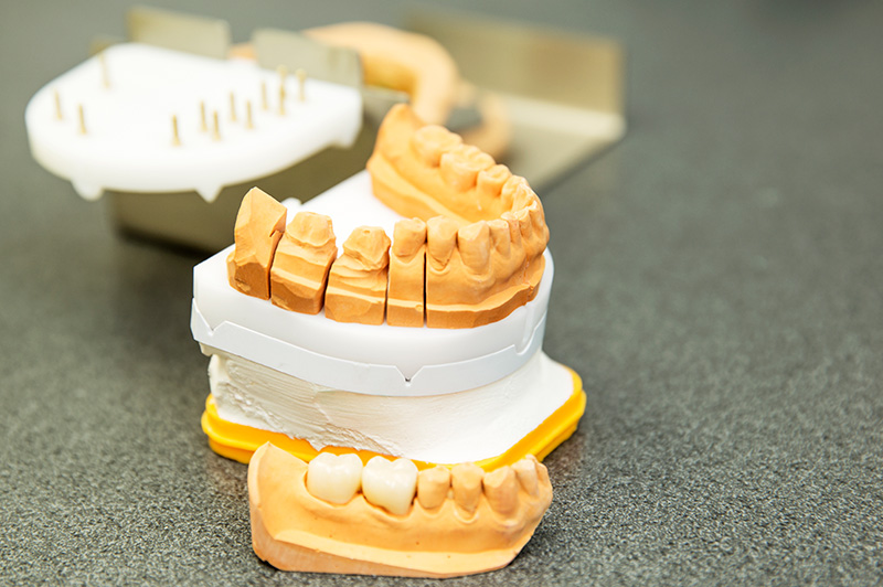 Fotogalerie Dentallabor