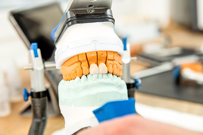 Fotogalerie Dentallabor