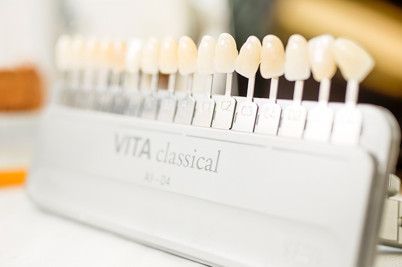 Fotogalerie Dentallabor
